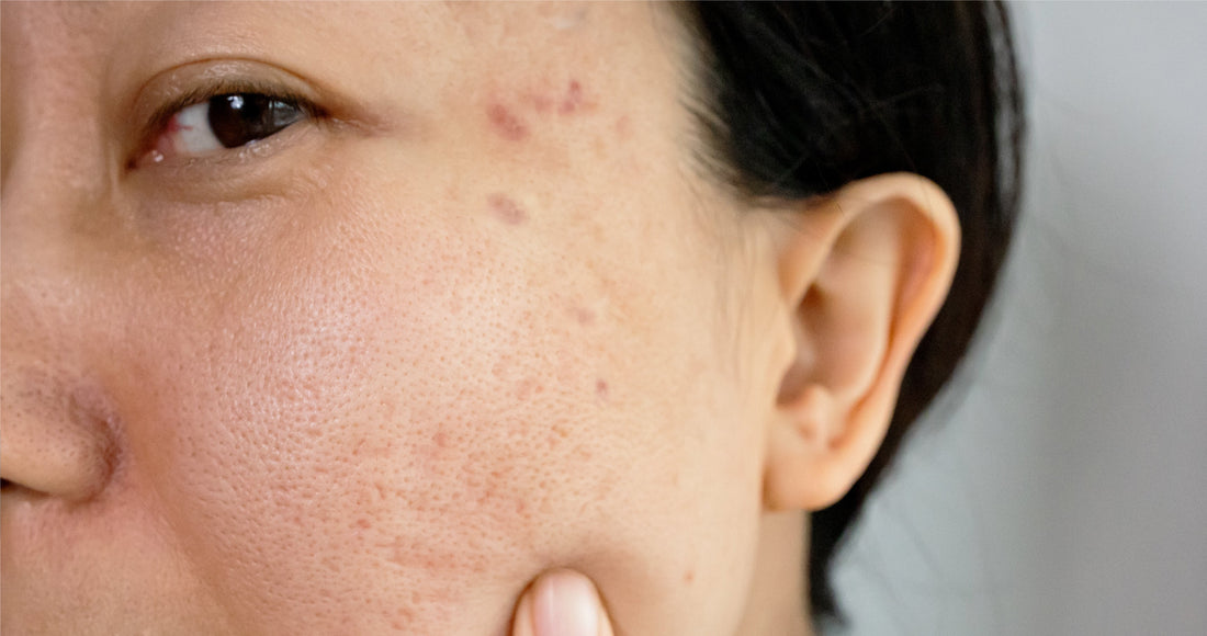 A Pair of Powerful Serums for Melanin Management